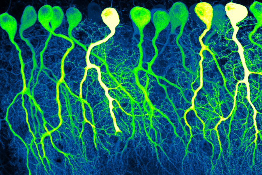 Dark Commute at 4am - First Place Photo Winner 2023. A confocal image of sparse GCaMP6f-expressing Purkinje cells in mouse cerebellum resembles the industrious contours of pre-dawn commuters.