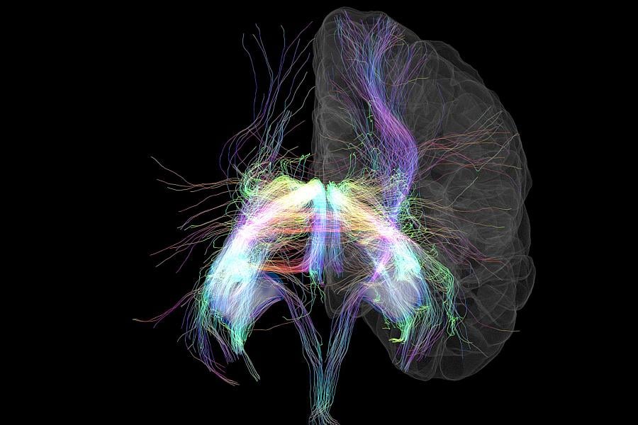 Memory Lanes. Third Place Photo Winner 2023. A rendering of MRI data –combining cortical surface and hippocampal segmentations from a T1 weighted scan and diffusion tractography.