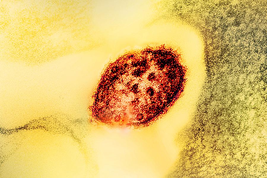 Image of a colorized transmission electron micrograph of a measles virus particle (red). 