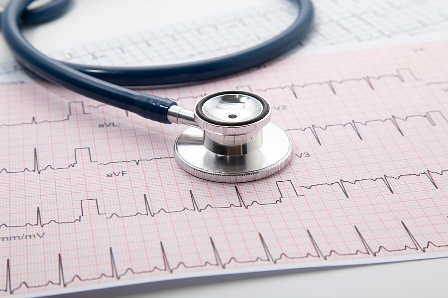 Image of blue Stethoscope on electrocardiogram chart paper.