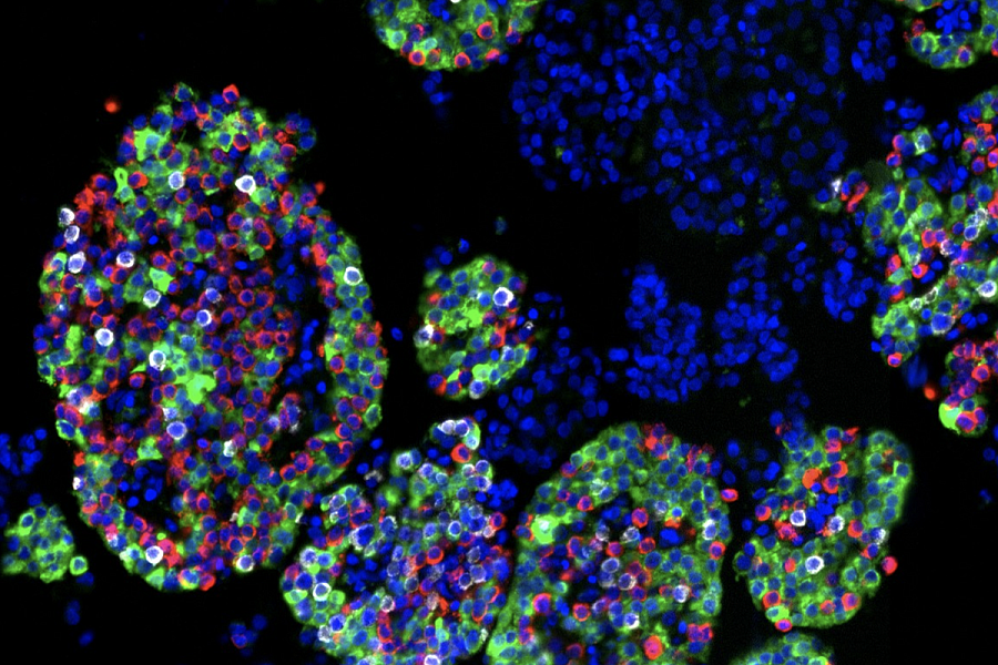 Isolated islets showing cell nuclei (blue) and three main endocrine cell types: insulin-producing beta cells (green), glucagon-producing alpha cells (red), and somatostatin-producing delta cells (white).