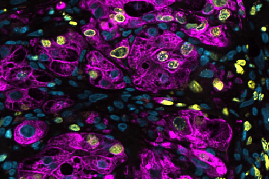 Microscope image of genetically engineered 3D liver cells. 