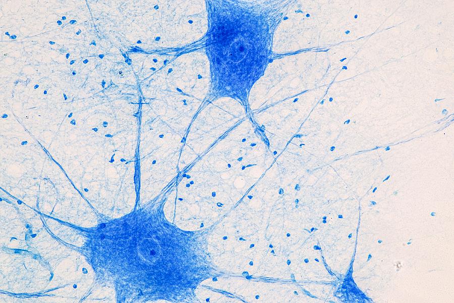 Motor neuron under the microscope.