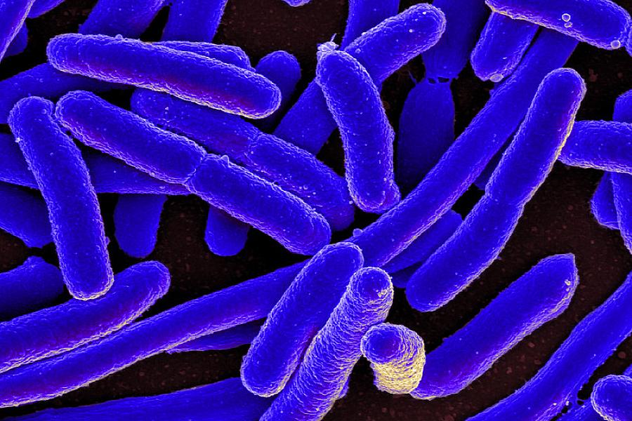 Electron microscope image of Escherichia coli.
