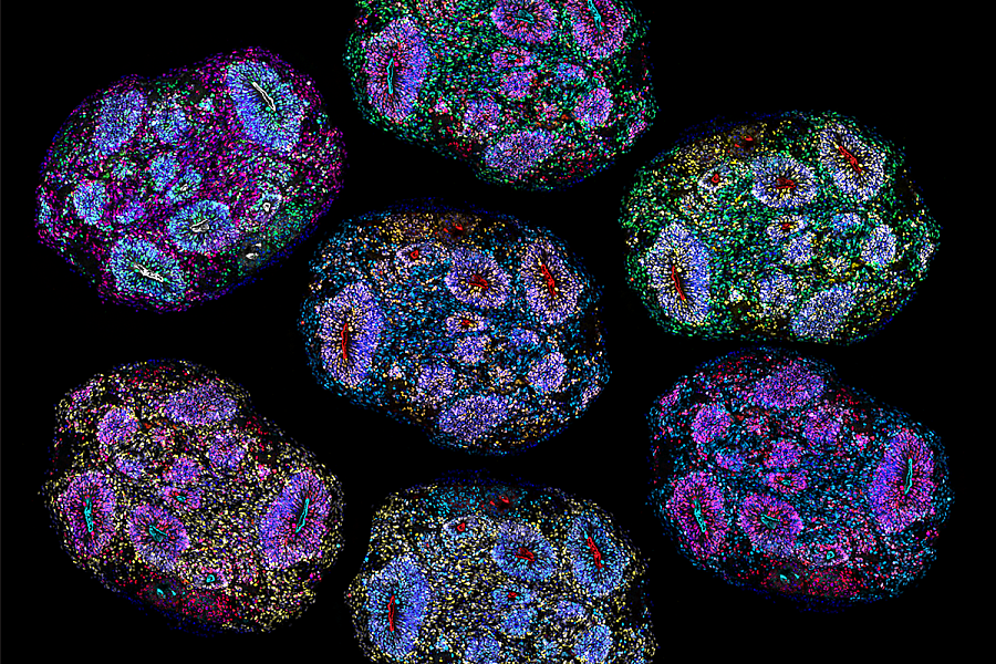 Image of multiple, colorful cross sections of the organoids arranged to almost look like fireworks.