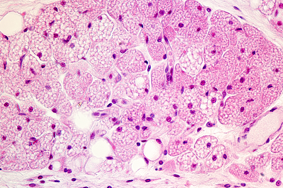 NIH, NIDDK, brown fat, white fat, heart disease, blood pressure, hypertension, diabetes, heart failure, cardiovascular disease, psychiatric disease, angiotensin blockers, losartan