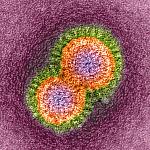 Image of influenza virus particles.