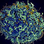 Image of a t-cell infected with HIV.