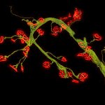 Leg Muscle from Mouse Model of Pompe Disease