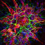 Choroidal neovascularization
