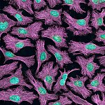 Multiphoton fluorescence image of HeLa cells