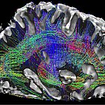 Illustration of a human brain.