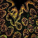 Image of colon tissue and nano-particles