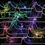 Image of neuron firing patterns
