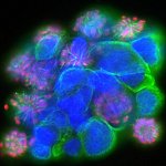 Patient-derived glioma stem cells