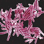 Mycobacterium tuberculosis.