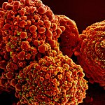Colorized scanning electron micrograph of a cell infected with the Omicron strain of SARS-CoV-2 virus particles (yellow and green), isolated from a patient sample.