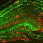 Mouse model of Alzheimer's disease.