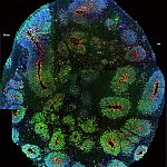 Image of a human cortex organoid