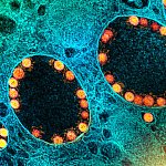 Novel Coronavirus SARS-CoV-2