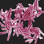 Scanning electron micrograph of Mycobacterium tuberculosis bacteria, which cause TB. 