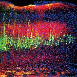 Image of green and magenta neurons in mouse auditory cortex