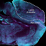 Image of a t-hCO in a rat cortex