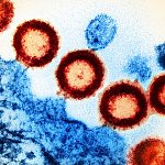 HIV-1 Virus