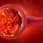 Normal level of LDL cholesterol in the arteries. Atherosclerosis disease initial stage 3D illustration: atherosclerotic plaques, red blood cells. Cholesterol in the blood vessels, risk of thrombosis