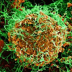 Ebola Virus Particles