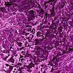 Monkeypox Virus Colorized scanning electron micrograph of monkeypox virus (blue) on the surface of infected VERO E6 cells (pink).