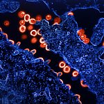 HIV Virus