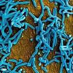 SEM image of rod-shaped Marburg virus particles, colorized blue.