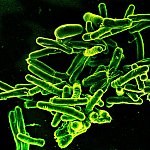 Scanning electron micrograph showing Mycobacterium tuberculosis bacteria (green), which cause TB.