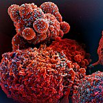 Colorized scanning electron micrograph of a cell (red) infected with the Omicron strain of SARS-CoV-2 virus particles (blue), isolated from a patient sample.