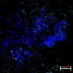 Image of a skin biopsy under microscope
