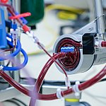 photo of ECMO machine