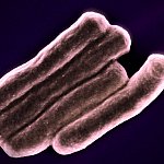Four oblong TB particles, colorized pink.