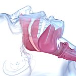 Anatomy illustration of sleep apnea