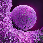 Novel Coronavirus SARS-CoV-2 (Omicron)