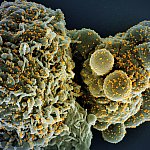 Colorized scanning electron micrograph of a cell (green) infected with the Omicron strain of SARS-CoV-2 virus particles (gold), isolated from a patient sample. Image captured at the NIAID Integrated Research Facility (IRF) in Fort Detrick, Maryland.