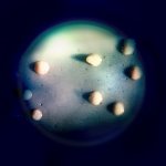 Cultivated colonies of the bacterium Mycobacterium avium appear as eight, round beige objects inside a round petri dish. The dish appears as a faded, dim, blue-green background surrounded by the color black.