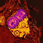 Microscopic image of a human neutrophil 