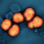 A colorized transmission electron micrograph of circular influenza A virus particles, colorized orange in this image, on a dark blue background.