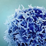 Colorized scanning electron micrograph of a T lymphocyte  (also known as a T cell) (blue). 