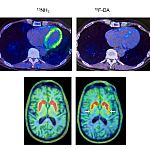 Heart and brain PET scans from a study participant