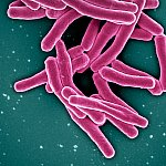 Mycobacterium Tuberculosis Bacteria, the Cause of TB