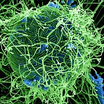 Ebola Virus Particles