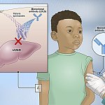 Illustration that shows how the monoclonal antibody neutralizes the malaria parasite.