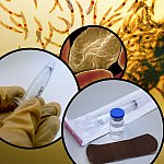 Background image of malaria parasites with foreground photo montage showing infected red blood cell, mosquito, and vaccine vial